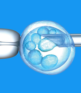 Embryo Biopsy